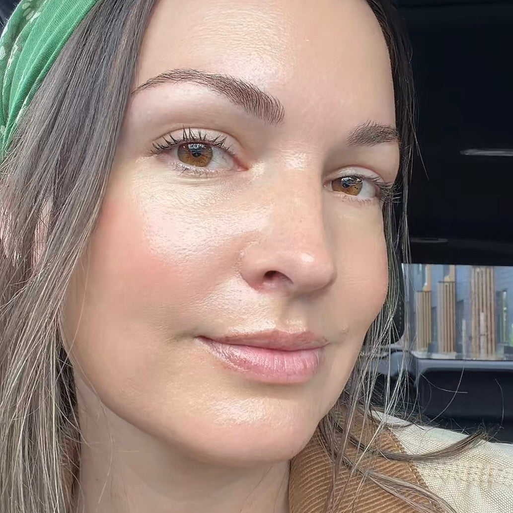 Alternative Options To Botox & Fillers