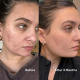 Prickly Pear Face Oil