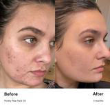 Prickly Pear Face Oil