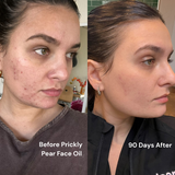 Prickly Pear Face Oil
